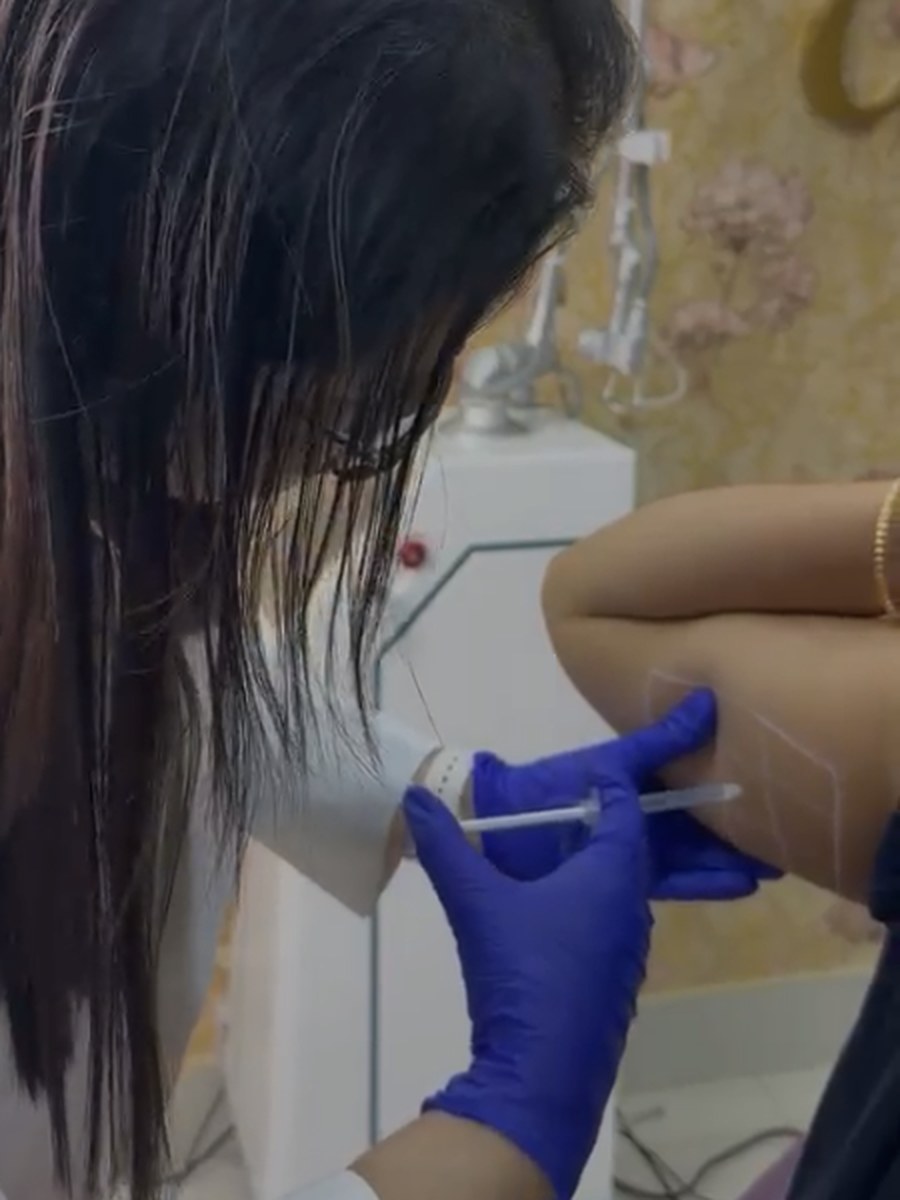 Dr. Sifat-E-Aman administering an injectable treatment to a patient's arm, gloved, at her chamber.