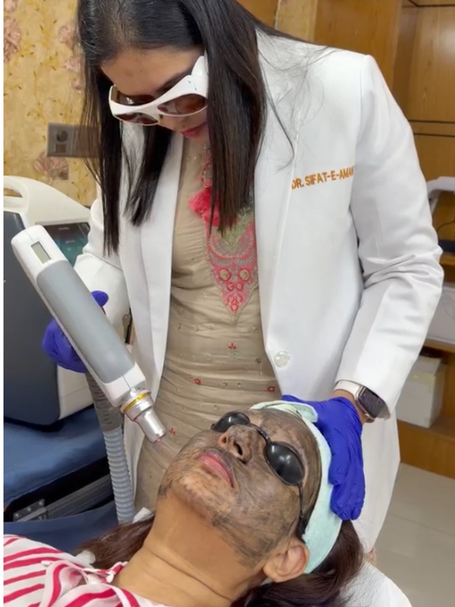 Dr. Sifat-E-Aman in her white coat and laser safety goggles, operating a laser handpiece over a patient during a carbon-peel treatment at her chamber.